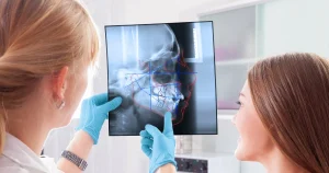 AI-driven ceph tracing software